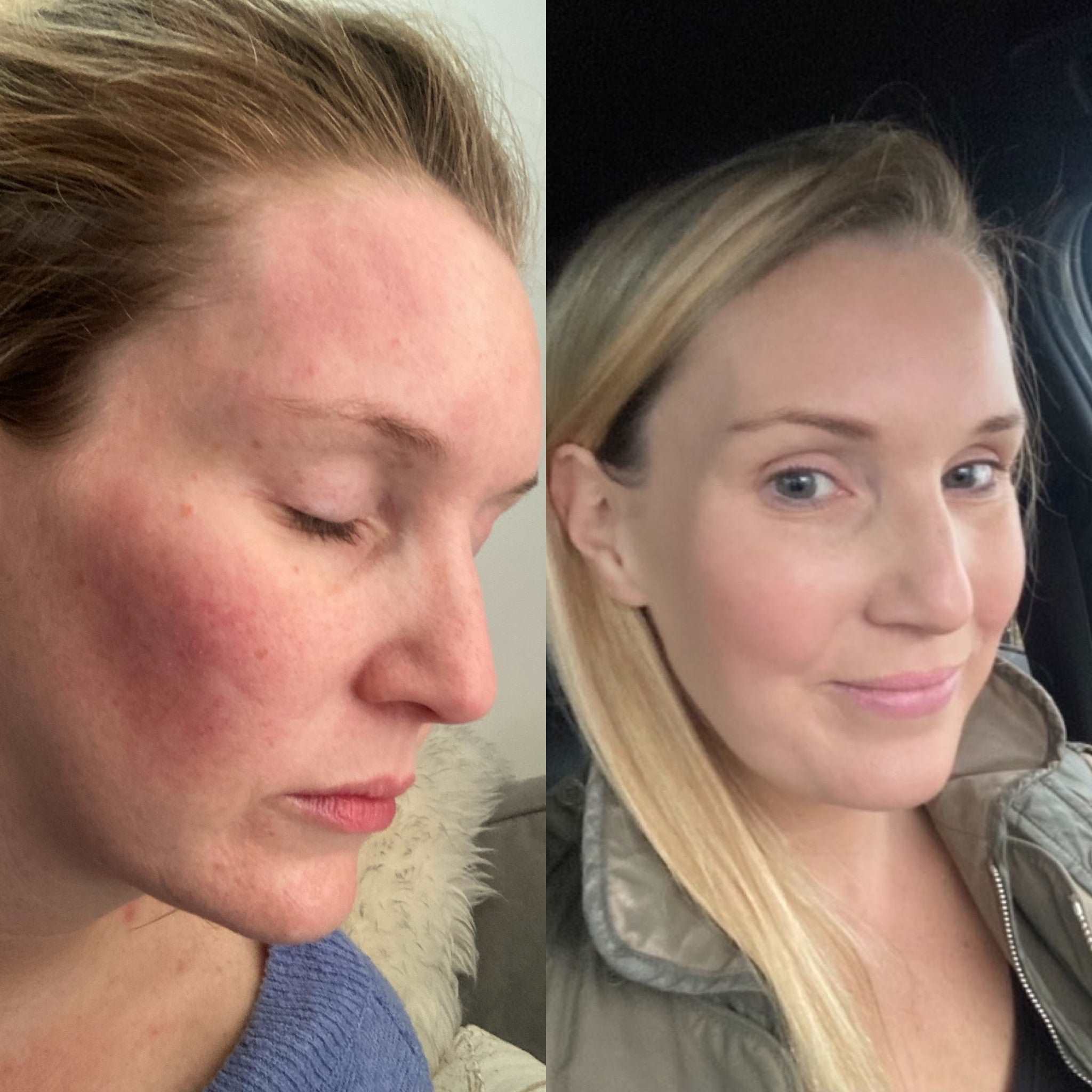 Coconut & Rosehip Calming Cream -White Rabbit